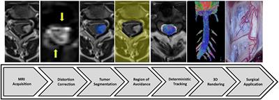 Full cervical cord tractography: A new method for clinical use